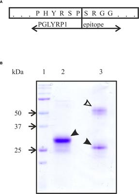 Human Short Peptidoglycan Recognition Protein PGLYRP1/Tag-7/PGRP-S Inhibits Listeria monocytogenes Intracellular Survival in Macrophages